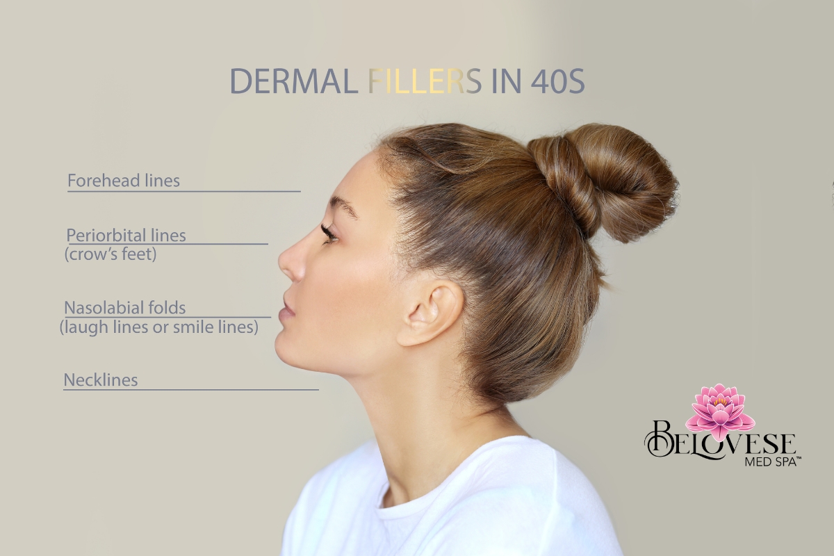 Why Women in Tifton Are Turning to Dermal Fillers to Look Rested — Not Different