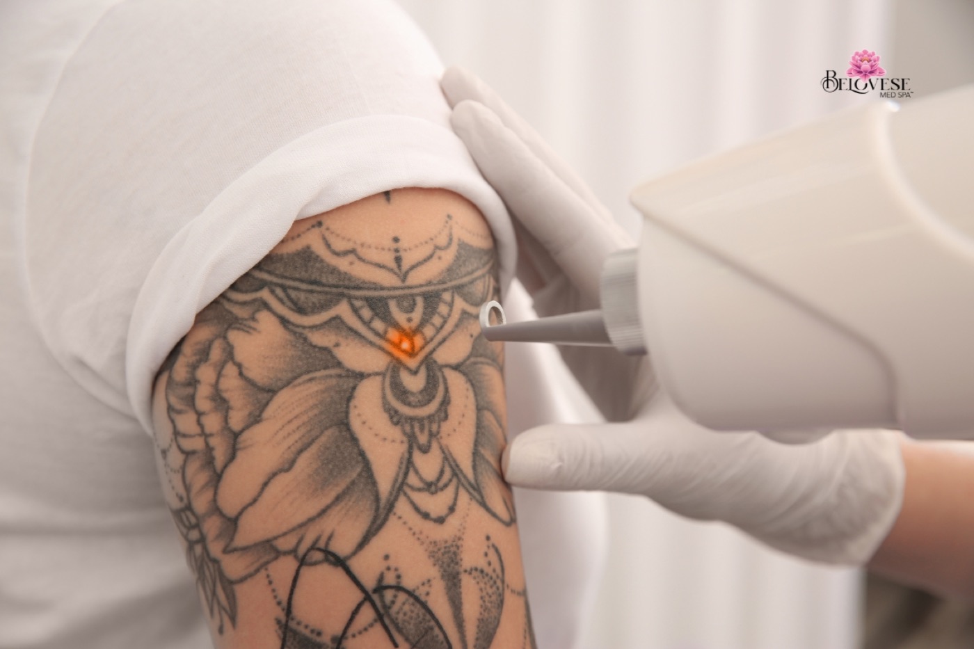 How Many Sessions Does Tattoo Removal Take? 2026 Complete Guide